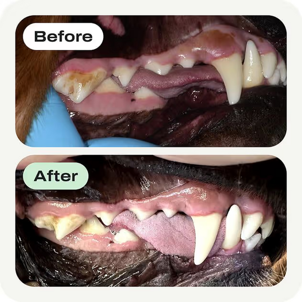 Less Plaque Buildup Over Time